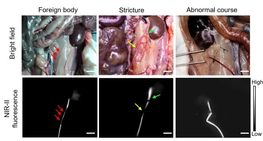 香港科大唐本忠院士團(tuán)隊(duì)與蘇州大學(xué)附一院侯建全教授團(tuán)隊(duì)合作：近紅外II區(qū)聚集誘導(dǎo)發(fā)光的熒光探針實(shí)現(xiàn)術(shù)中輸尿管成像