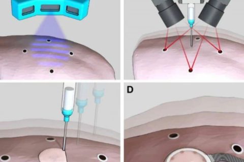 《Science》子刊：在活體器官上原位3D打印可變形水凝膠傳感器！