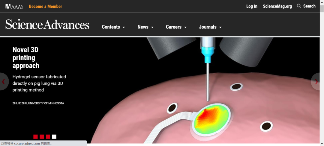 《Science》子刊：在活體器官上原位3D打印可變形水凝膠傳感器！