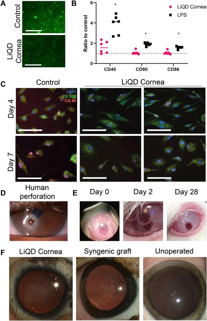 Science子刊重磅：無需角膜移植手術(shù)！新型可注射水凝膠膠原蛋白基質(zhì)仿生角膜和“膠填充劑”