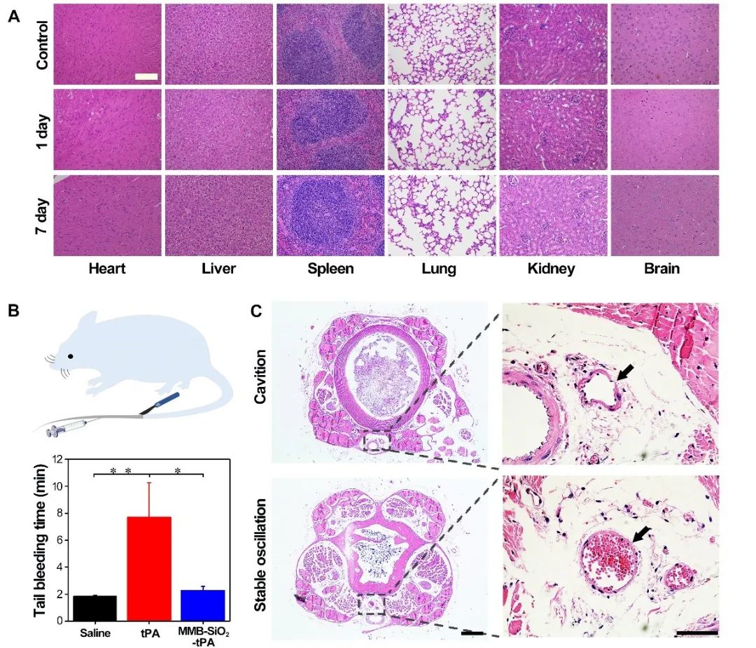 南京郵電大學汪聯(lián)輝、高宇《Sci. Adv.》：磁場、超聲波助力納米組裝體加速溶栓