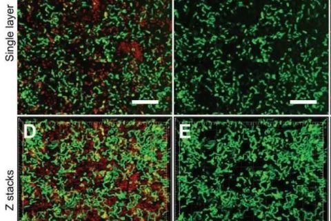 新加坡國(guó)立大學(xué)《AFM?》：肉眼可見(jiàn)！共軛低聚電解質(zhì)助力革蘭氏細(xì)菌的區(qū)分