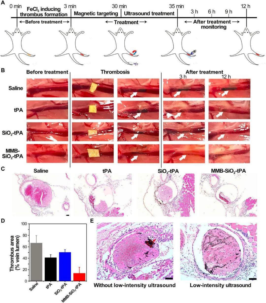 南京郵電大學汪聯(lián)輝、高宇《Sci. Adv.》：磁場、超聲波助力納米組裝體加速溶栓