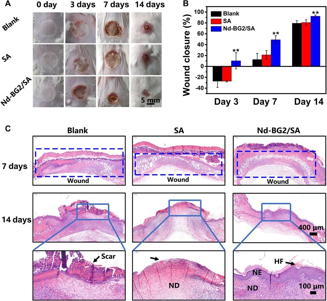 中科院硅酸鹽所常江團隊?Science子刊—— “水凝膠溫度計”助力光熱療法突破瓶頸