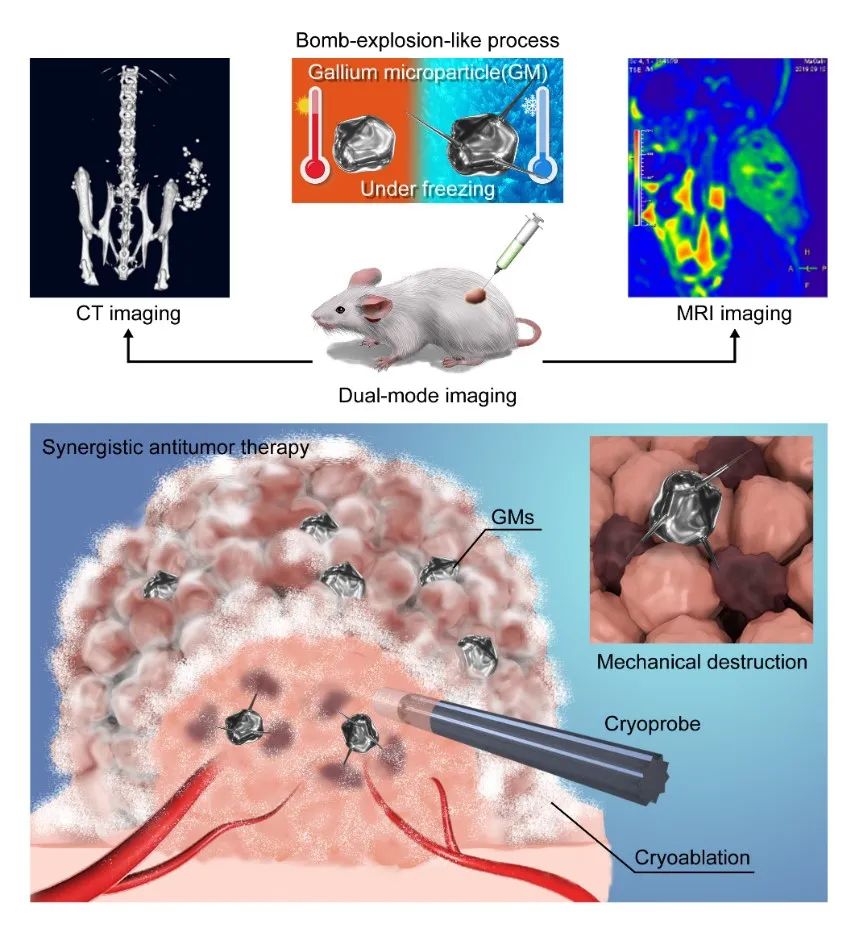 《AFM》：發(fā)現(xiàn)液態(tài)金屬凍結(jié)微爆破現(xiàn)象及其增強(qiáng)腫瘤殺傷與MRI-CT雙模態(tài)成像機(jī)制