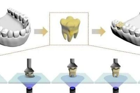 強(qiáng)大，一滴樹(shù)脂就能打印一顆牙齒！中科院化學(xué)所實(shí)現(xiàn)單液滴3D打印技術(shù)