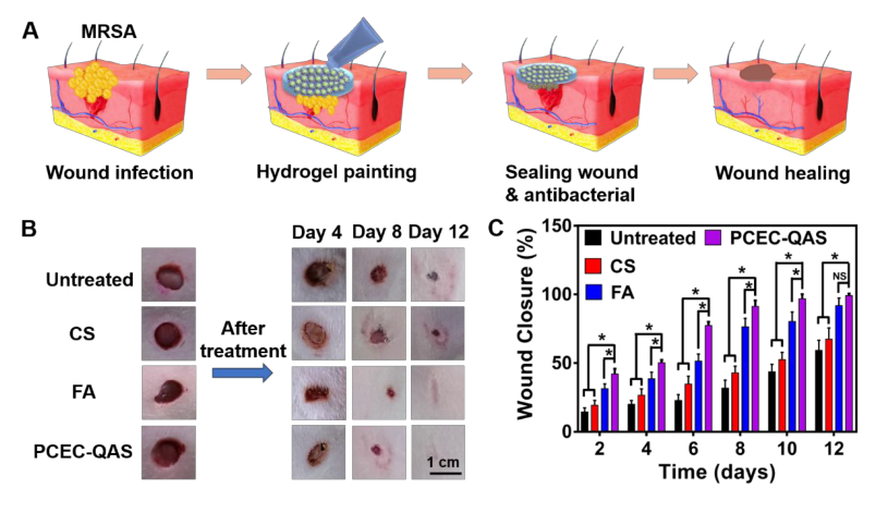 醫(yī)科院王偉偉等《ACS Nano》：直達真皮層，100%修復(fù)：合成高分子抗菌水凝膠用于耐甲氧西林金黃色葡萄球菌感染傷口愈合