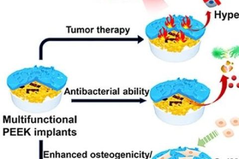 四川大學(xué)鄧怡團隊《ACS AMI》：為醫(yī)用特種高分子尋“醚”新功能——具有抗癌抑菌雙功能的聚醚醚酮植入材料