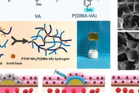 青島大學叢海林教授：原位注射聚四氫嘧啶自愈合抗菌水凝膠治療化膿性皮下感染