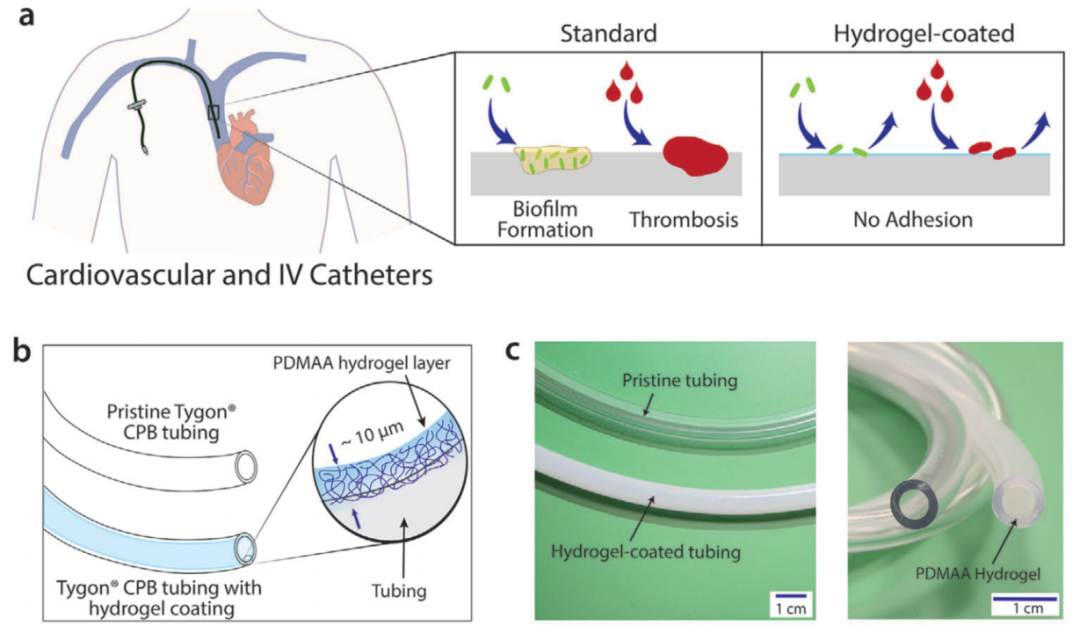 MIT趙選賀教授：超薄、耐用的水凝膠涂層：可同時(shí)減輕血栓和感染性并發(fā)癥